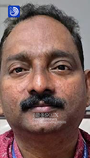 വിമാനാപകടത്തിൽ മരിച്ച രഞ്ജിതയെ അധിക്ഷേപിച്ച സംഭവം; ഡെപ്യൂട്ടി തഹസിൽദാർ കസ്റ്റഡിയിൽ